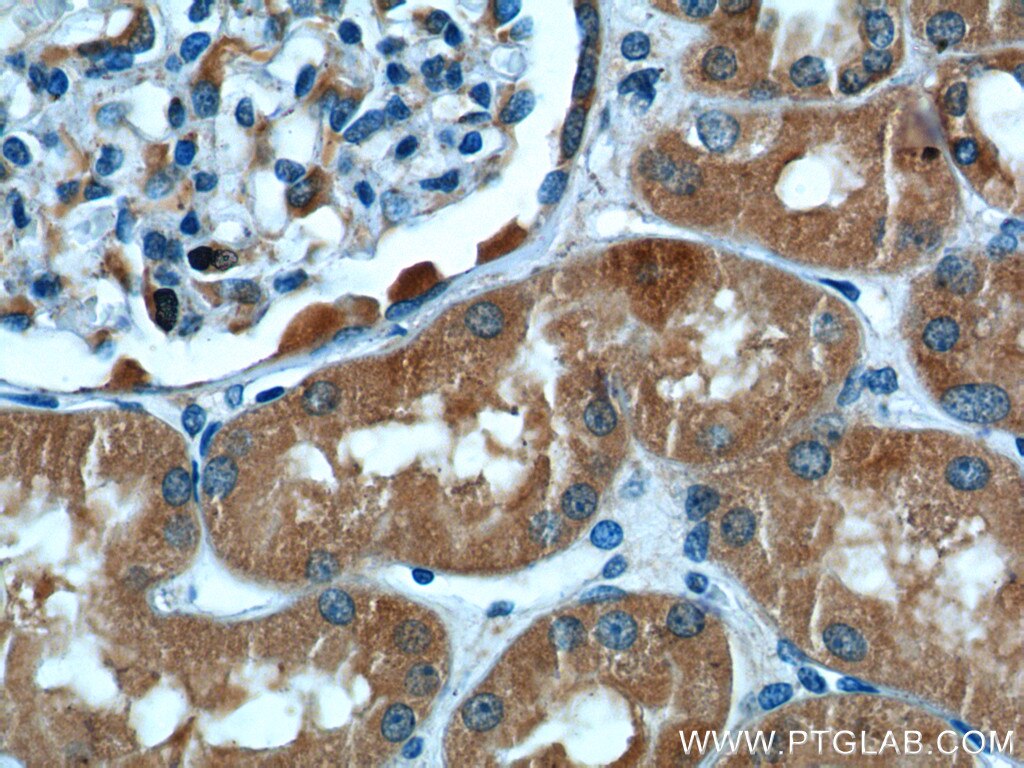 Immunohistochemistry (IHC) staining of human kidney tissue using ALDH9A1 Polyclonal antibody (26621-1-AP)