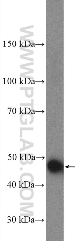 Western Blot (WB) analysis of HEK-293 cells using ALDH9A1 Polyclonal antibody (26621-1-AP)