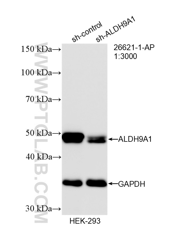 Western Blot (WB) analysis of HEK-293 cells using ALDH9A1 Polyclonal antibody (26621-1-AP)