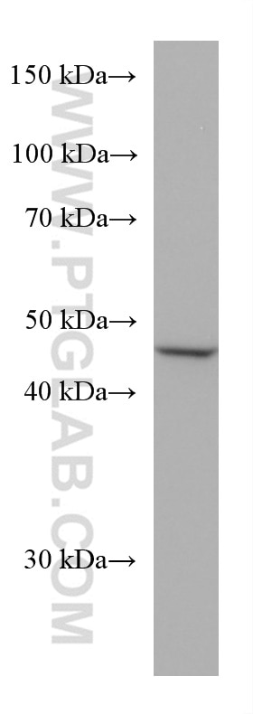 Western Blot (WB) analysis of HeLa cells using ALDH9A1 Monoclonal antibody (67372-1-Ig)