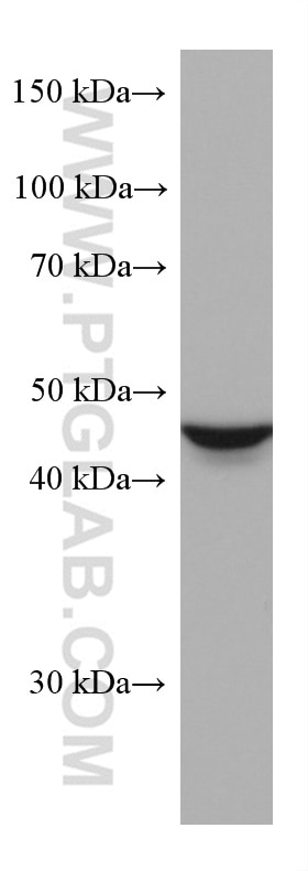 Western Blot (WB) analysis of HEK-293 cells using ALDH9A1 Monoclonal antibody (67372-1-Ig)