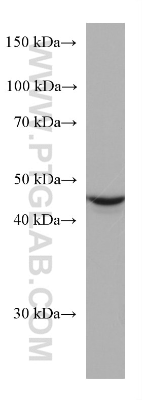 Western Blot (WB) analysis of Jurkat cells using ALDH9A1 Monoclonal antibody (67372-1-Ig)