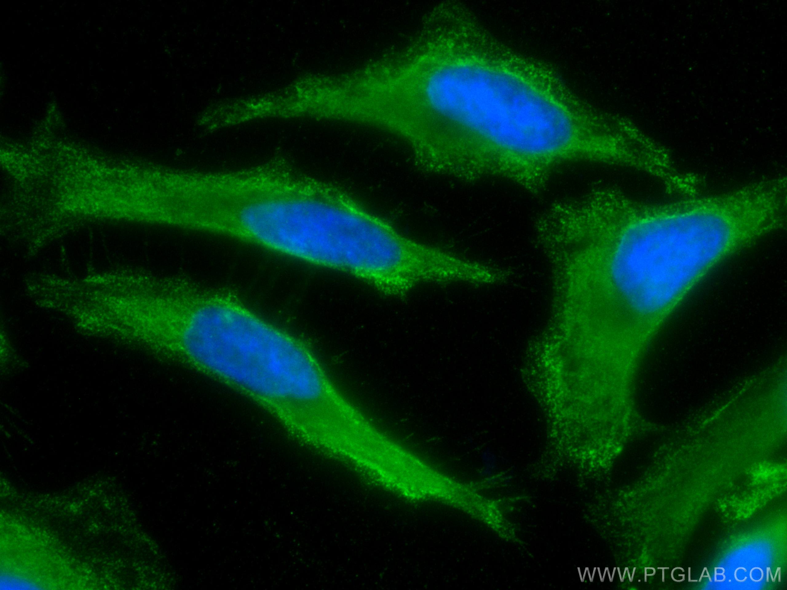 Immunofluorescence (IF) / fluorescent staining of HeLa cells using CoraLite® Plus 488-conjugated ALDH9A1 Monoclonal a (CL488-67372)
