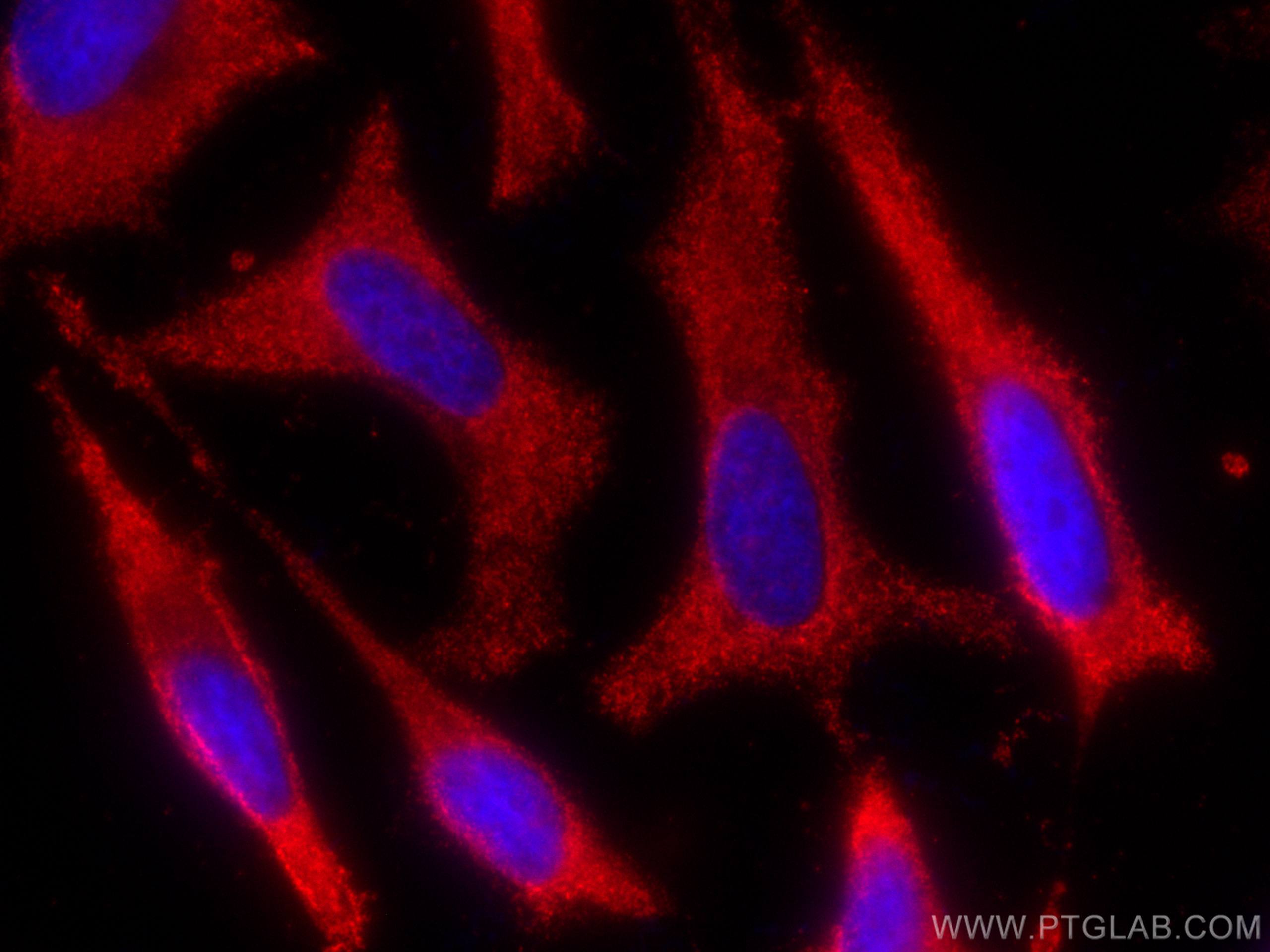 Immunofluorescence (IF) / fluorescent staining of HeLa cells using CoraLite®594-conjugated ALDH9A1 Monoclonal antibod (CL594-67372)