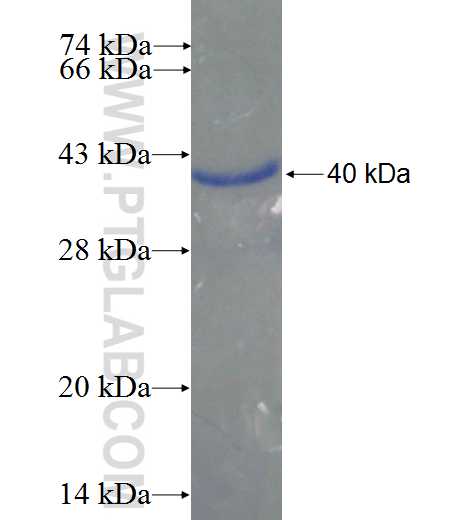 ALDH9A1 fusion protein Ag24312 SDS-PAGE