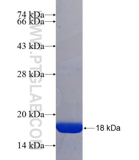 ALDH9A1 fusion protein Ag24493 SDS-PAGE