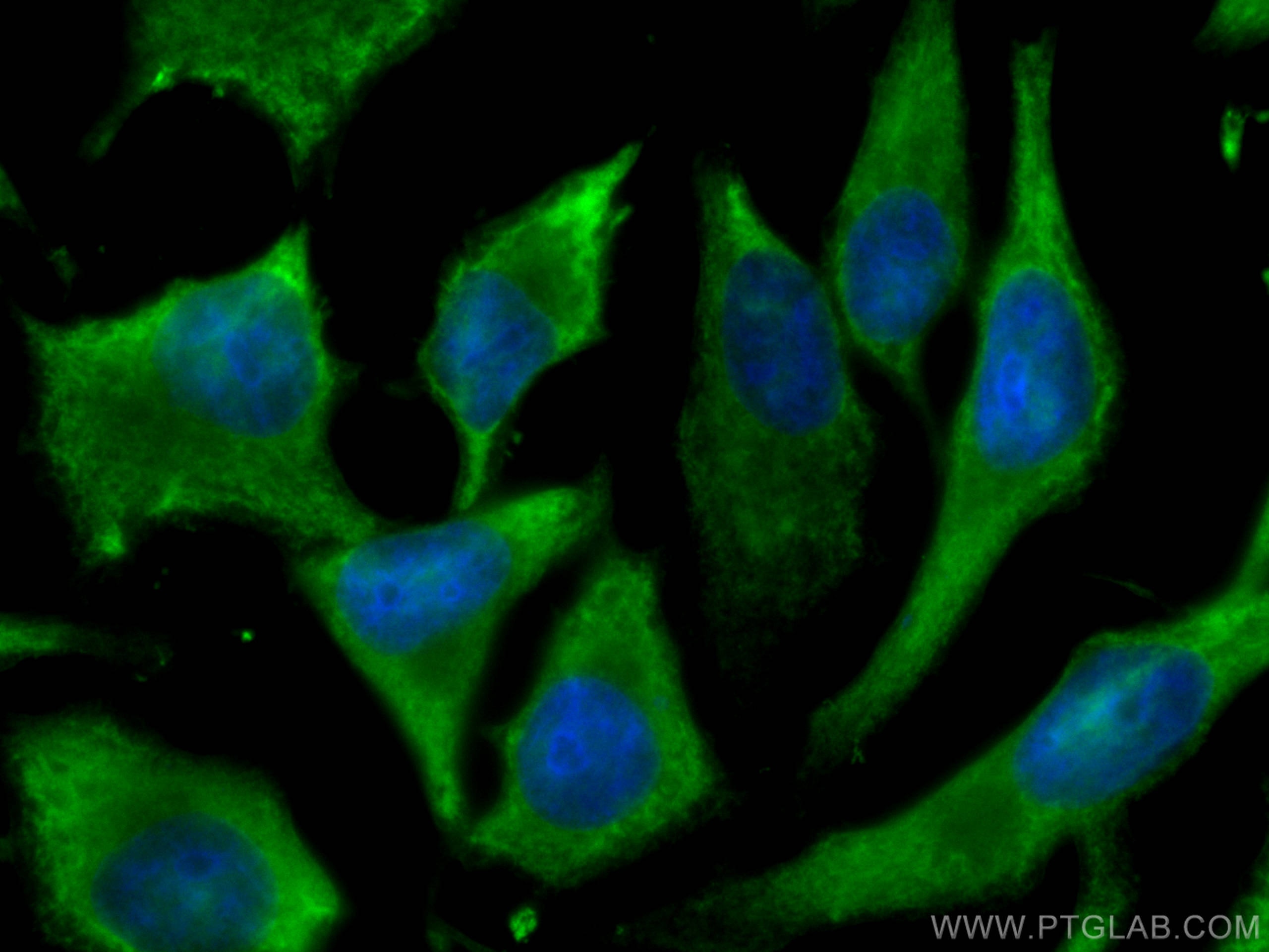 IF Staining of HeLa using 11217-1-AP