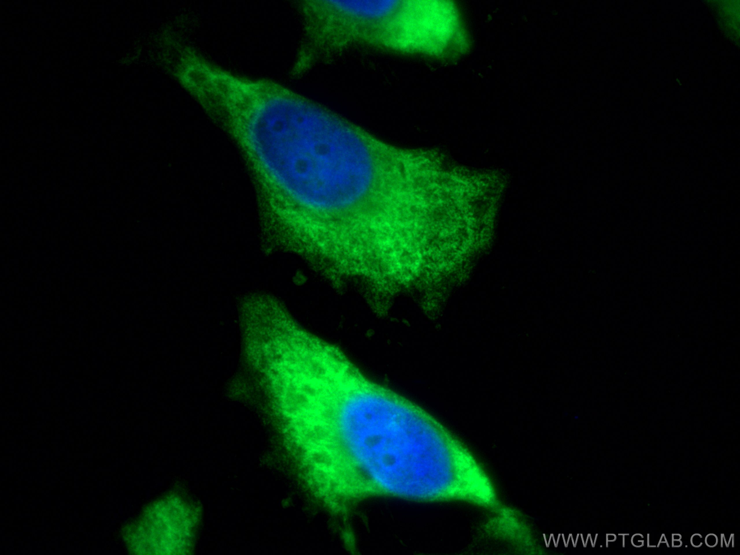 Immunofluorescence (IF) / fluorescent staining of HeLa cells using ALDOA Polyclonal antibody (11217-1-AP)