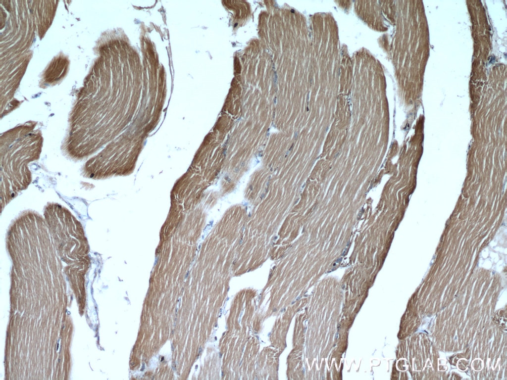 Immunohistochemistry (IHC) staining of human skeletal muscle tissue using ALDOA Polyclonal antibody (11217-1-AP)