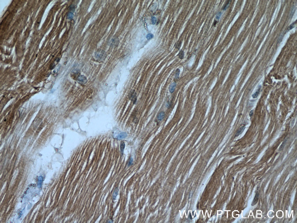 Immunohistochemistry (IHC) staining of human skeletal muscle tissue using ALDOA Polyclonal antibody (11217-1-AP)