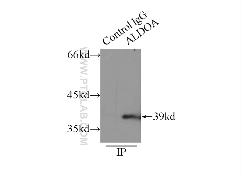 Immunoprecipitation (IP) experiment of HepG2 cells using ALDOA Polyclonal antibody (11217-1-AP)