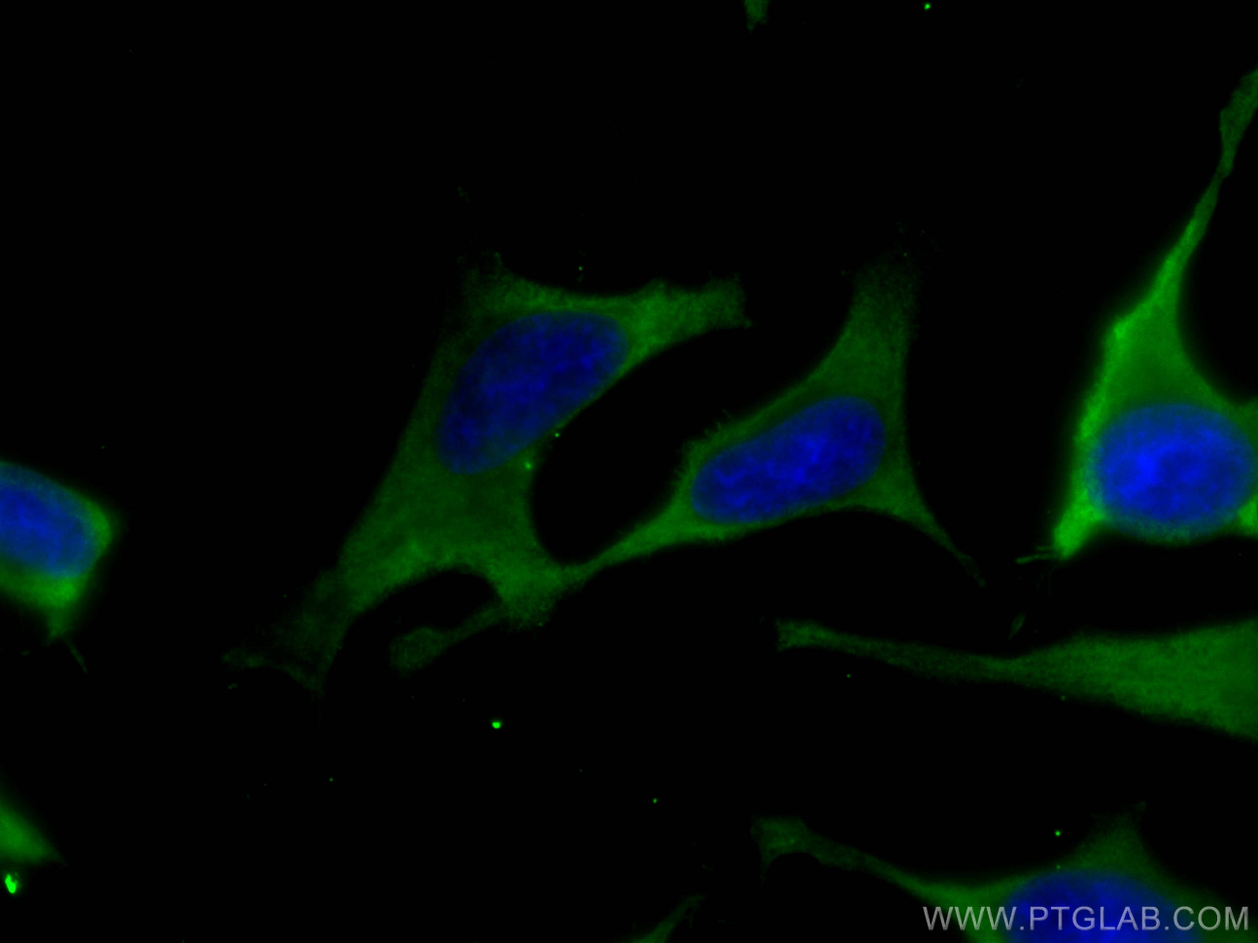 Immunofluorescence (IF) / fluorescent staining of HeLa cells using ALDOA Monoclonal antibody (67453-1-Ig)