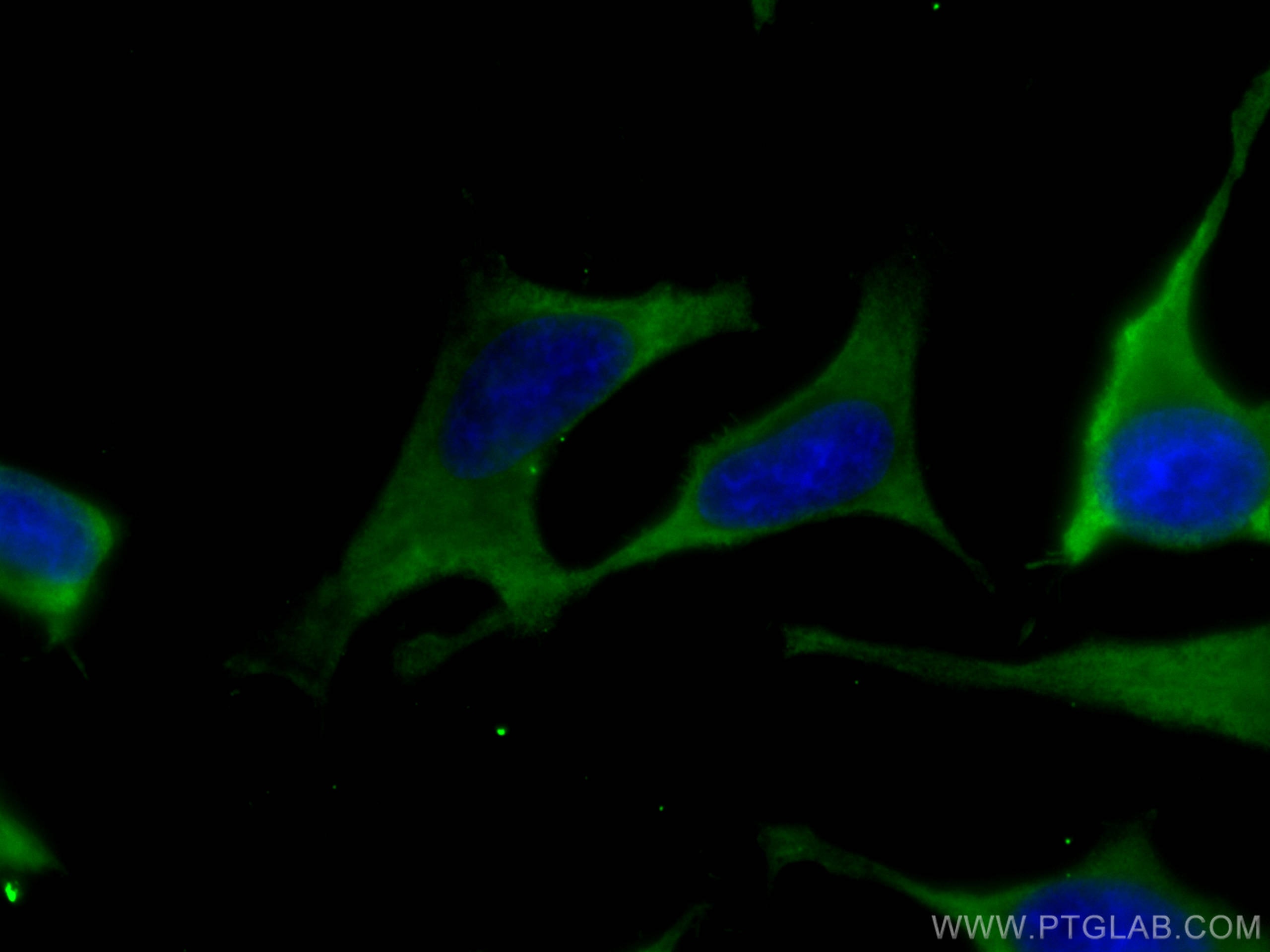 IF Staining of HeLa using 67453-1-Ig