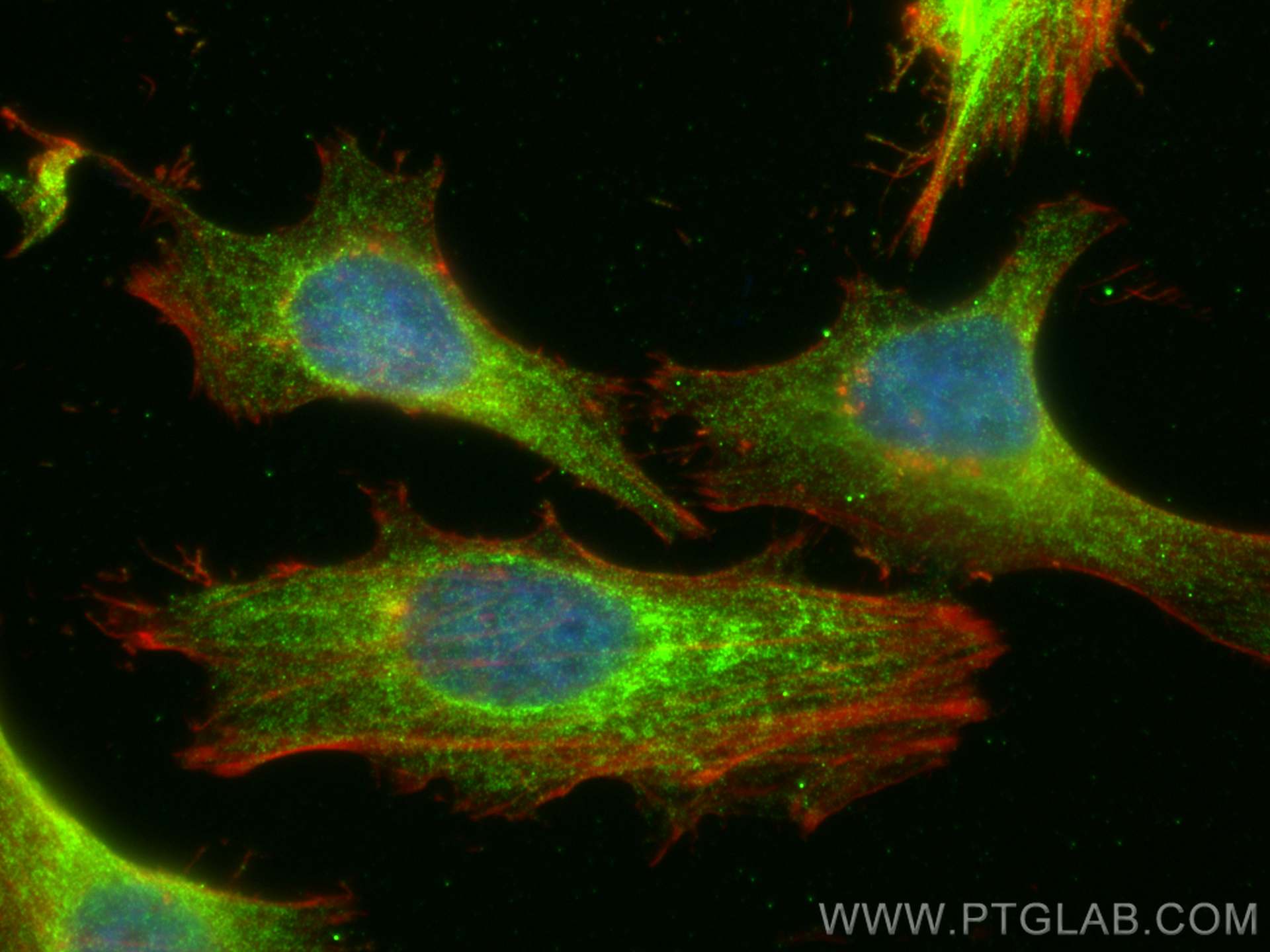 Immunofluorescence (IF) / fluorescent staining of HeLa cells using ALDOA Recombinant antibody (80837-1-RR)