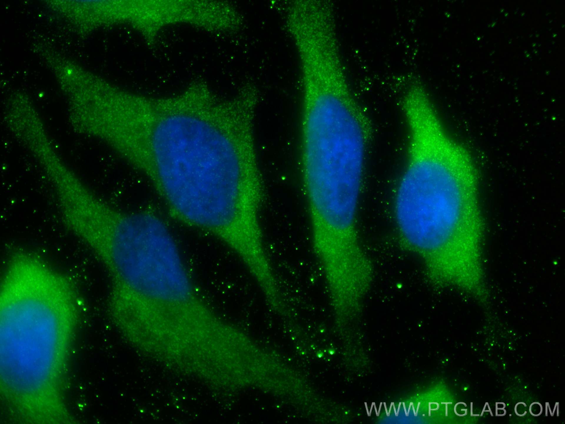 Immunofluorescence (IF) / fluorescent staining of HeLa cells using ALDOA Recombinant antibody (80837-1-RR)