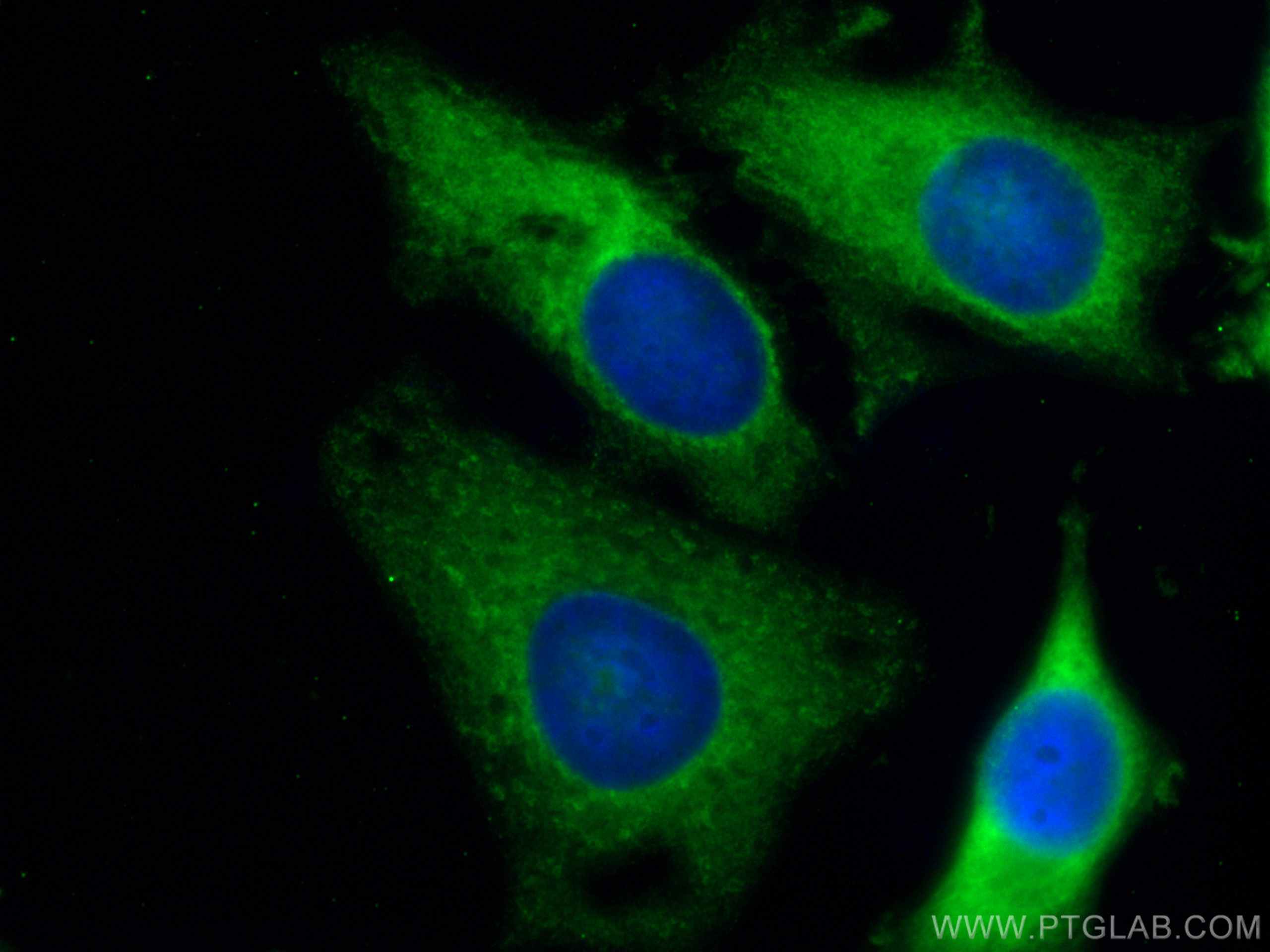 Immunofluorescence (IF) / fluorescent staining of HeLa cells using CoraLite® Plus 488-conjugated ALDOA Monoclonal ant (CL488-67453)