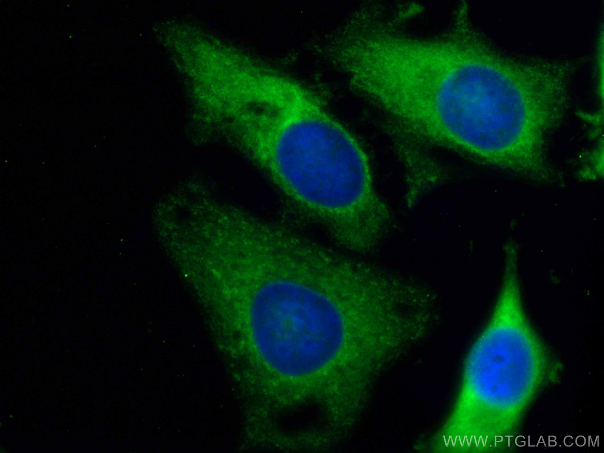 IF Staining of HeLa using CL488-67453