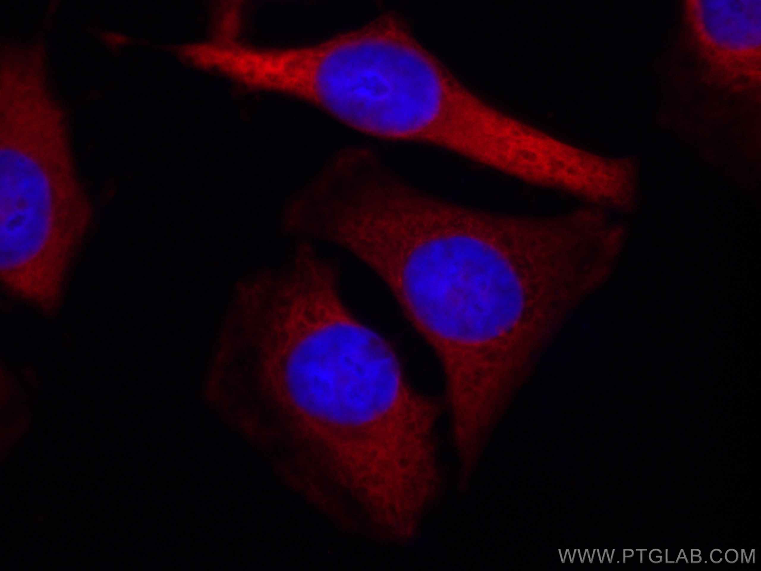 Immunofluorescence (IF) / fluorescent staining of HeLa cells using CoraLite®594-conjugated ALDOA Monoclonal antibody (CL594-67453)