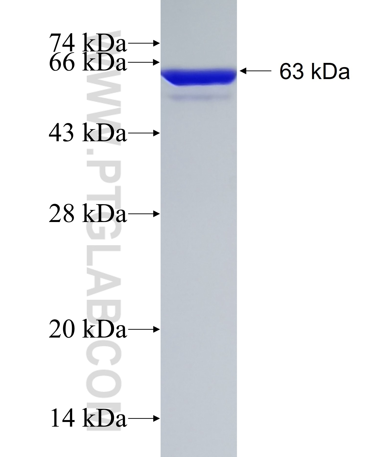 ALDOA fusion protein Ag1726 SDS-PAGE