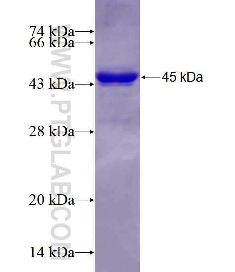 ALDOA fusion protein Ag17952 SDS-PAGE