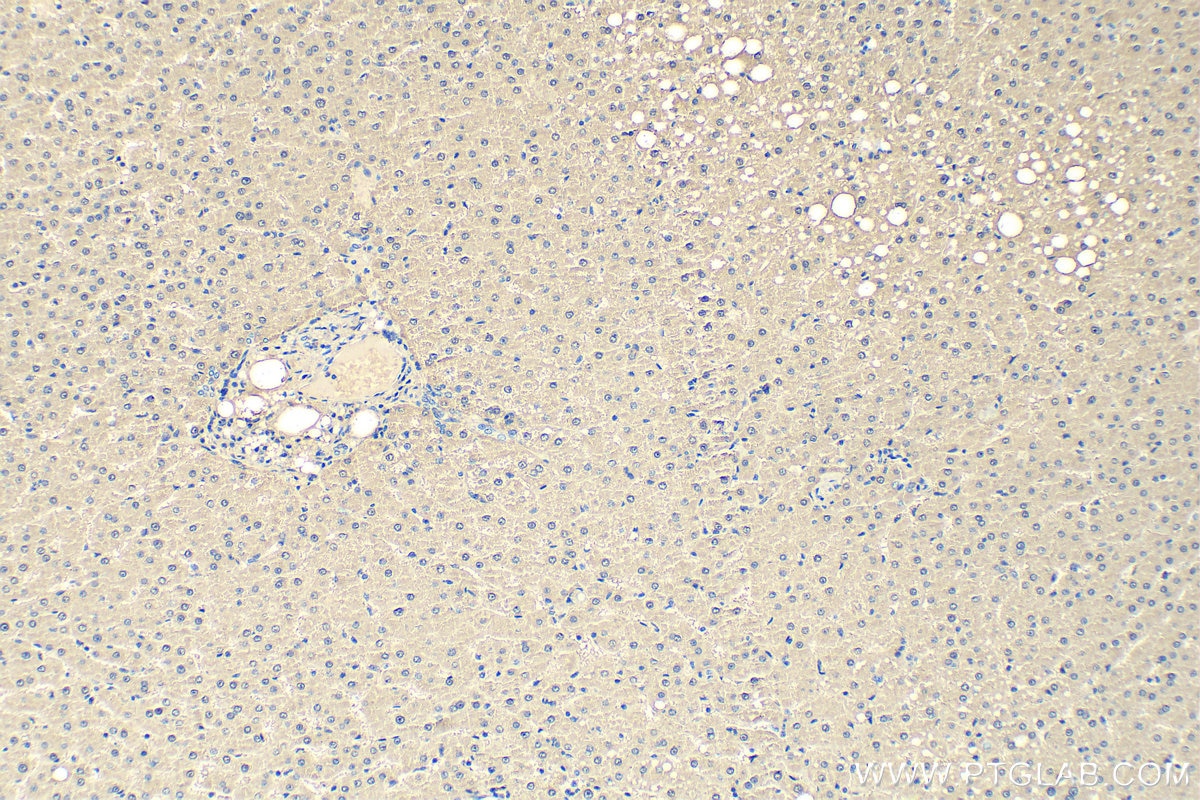 Immunohistochemistry (IHC) staining of human liver tissue using ALDOB Polyclonal antibody (18065-1-AP)