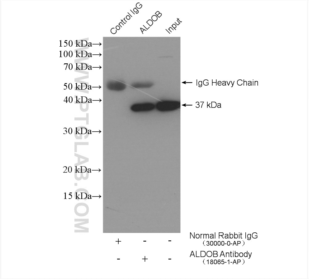 Immunoprecipitation (IP) experiment of mouse brain tissue using ALDOB Polyclonal antibody (18065-1-AP)