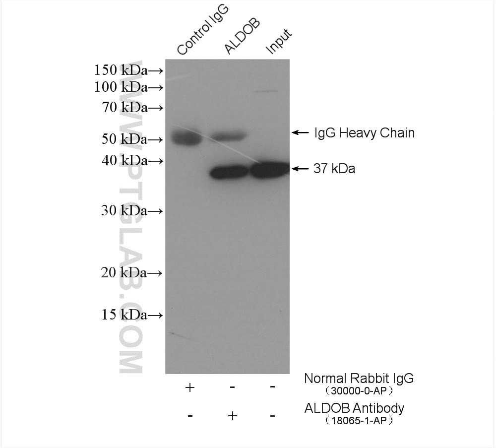 IP experiment of mouse brain using 18065-1-AP