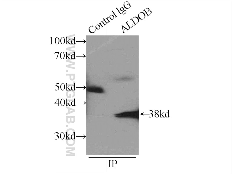 Immunoprecipitation (IP) experiment of mouse kidney tissue using ALDOB Polyclonal antibody (18065-1-AP)