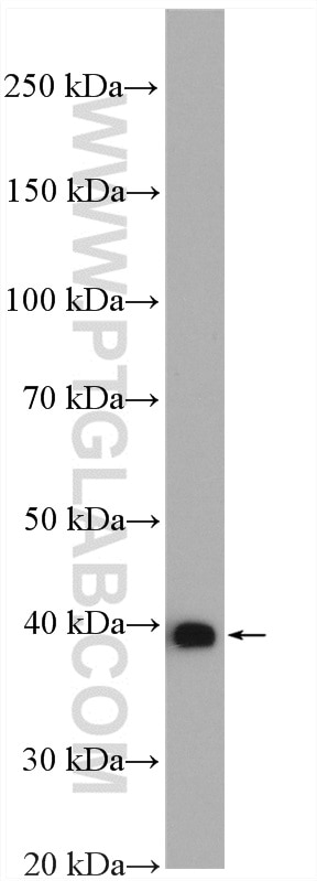 WB analysis of mouse brain using 18065-1-AP