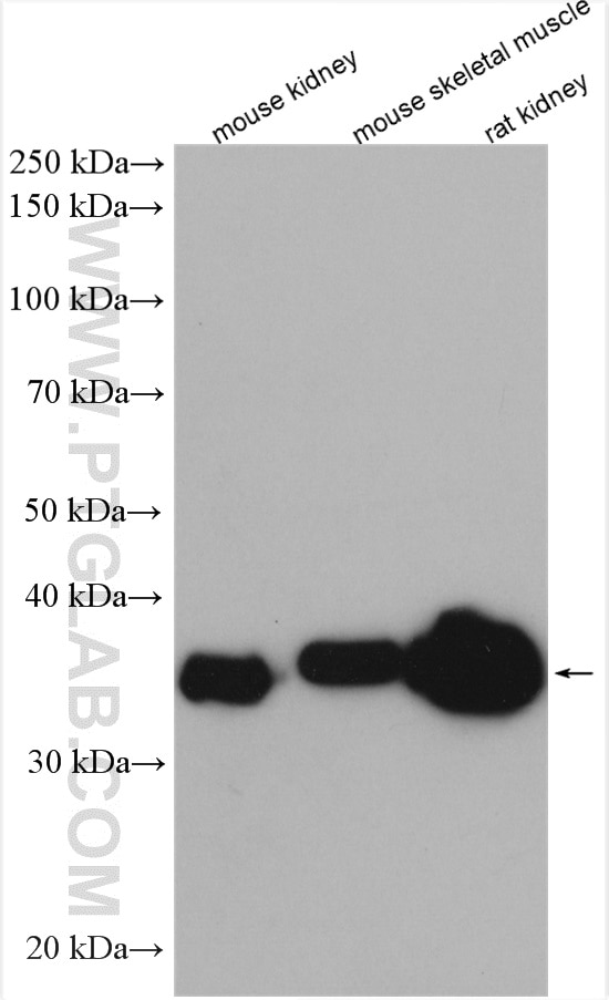 Western Blot (WB) analysis of various lysates using ALDOB Polyclonal antibody (18065-1-AP)