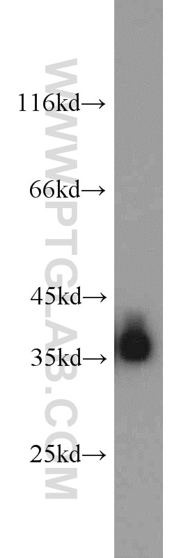 WB analysis of mouse liver using 18065-1-AP