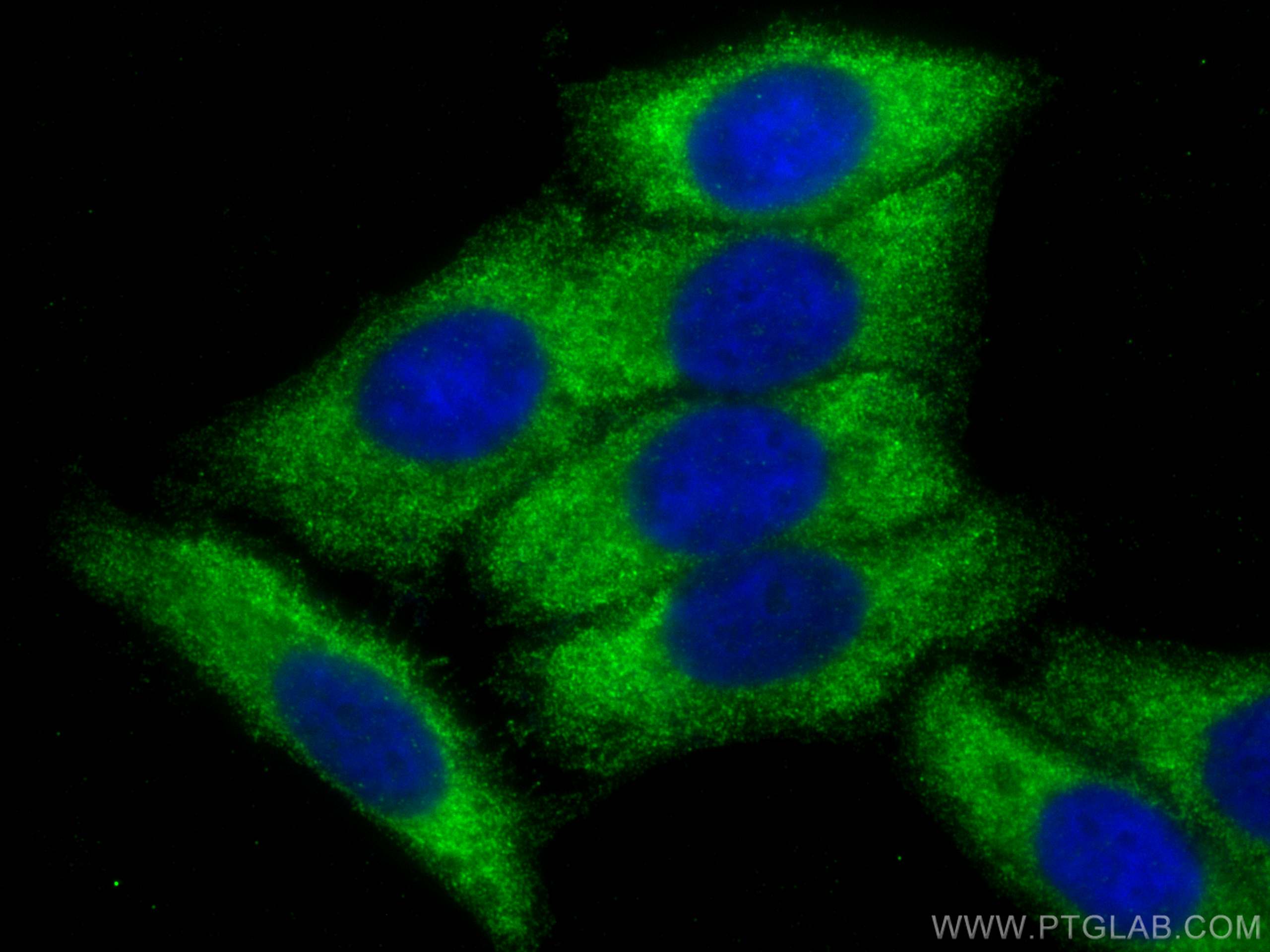 Immunofluorescence (IF) / fluorescent staining of HepG2 cells using ALDOB Monoclonal antibody (68396-1-Ig)