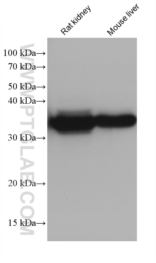 Western Blot (WB) analysis of various lysates using ALDOB Monoclonal antibody (68396-1-Ig)