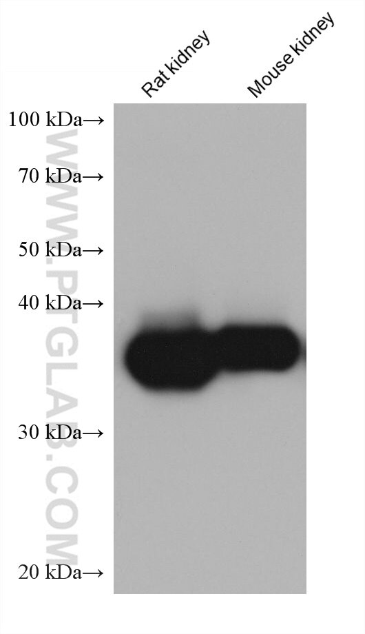 Western Blot (WB) analysis of various lysates using ALDOB Monoclonal antibody (68396-1-Ig)