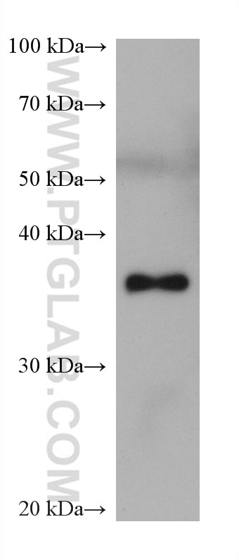 Western Blot (WB) analysis of human urine sample using ALDOB Monoclonal antibody (68396-1-Ig)