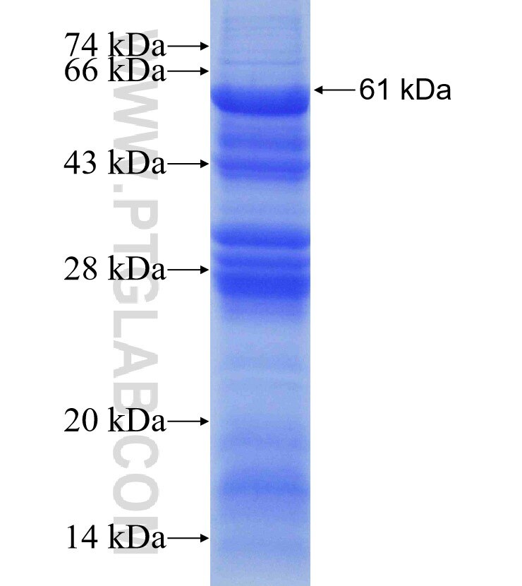 ALDOB fusion protein Ag12695 SDS-PAGE