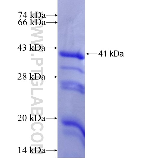 ALDOB fusion protein Ag12823 SDS-PAGE