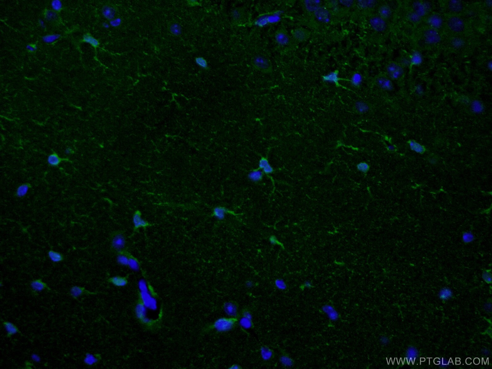 Immunofluorescence (IF) / fluorescent staining of mouse brain tissue using Aldolase C Polyclonal antibody (14884-1-AP)