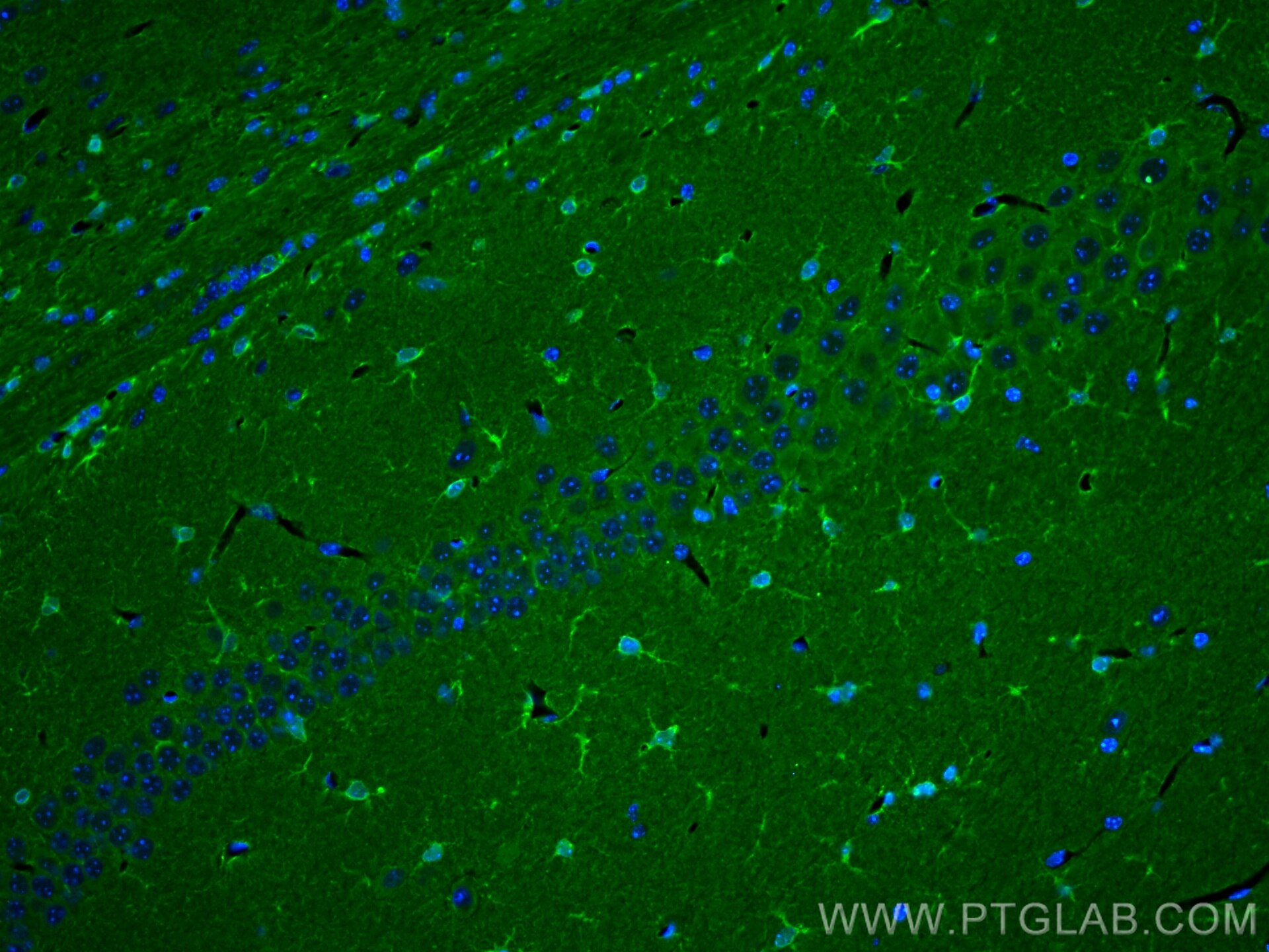 Immunofluorescence (IF) / fluorescent staining of mouse brain tissue using Aldolase C Polyclonal antibody (14884-1-AP)