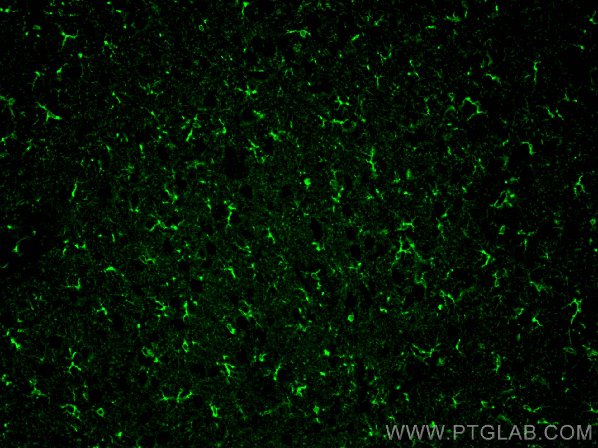 IF Staining of mouse brain using 14884-1-AP