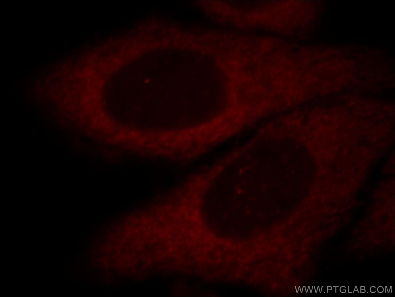 Immunofluorescence (IF) / fluorescent staining of HepG2 cells using Aldolase C Polyclonal antibody (14884-1-AP)