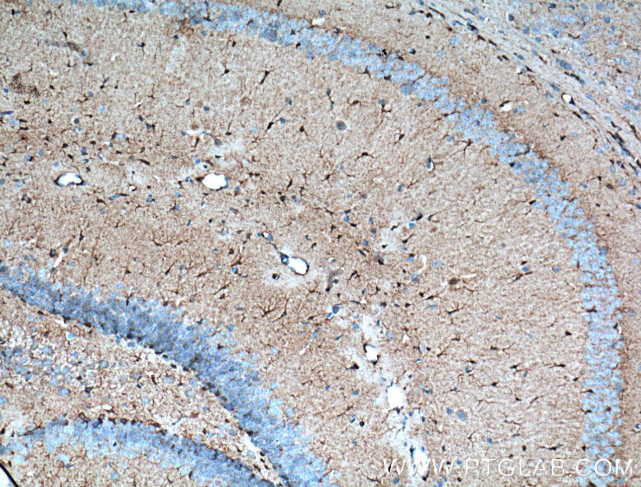 Immunohistochemistry (IHC) staining of mouse brain tissue using Aldolase C Polyclonal antibody (14884-1-AP)