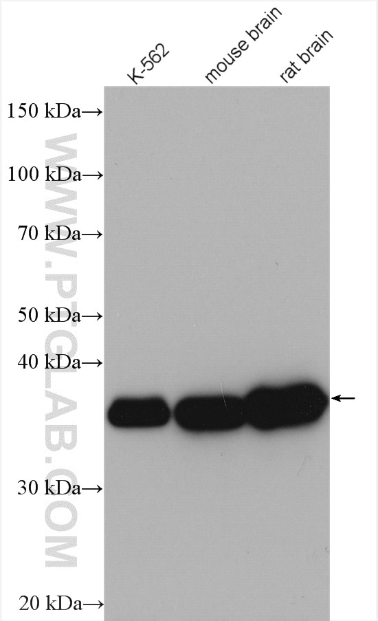 Western Blot (WB) analysis of various lysates using Aldolase C Polyclonal antibody (14884-1-AP)