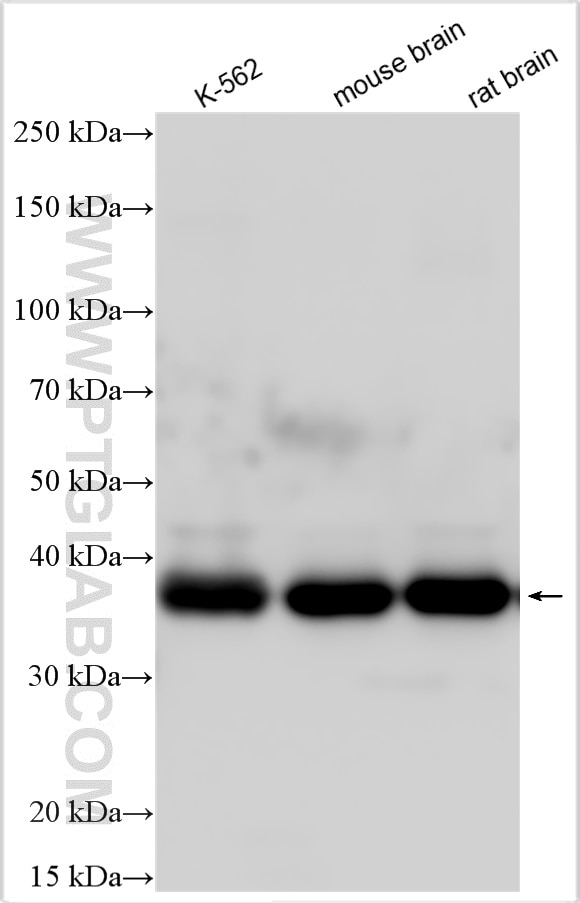 Western Blot (WB) analysis of various lysates using Aldolase C Polyclonal antibody (14884-1-AP)