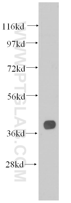 Aldolase C