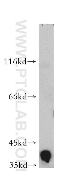 Western Blot (WB) analysis of human heart tissue using Aldolase C Polyclonal antibody (14884-1-AP)