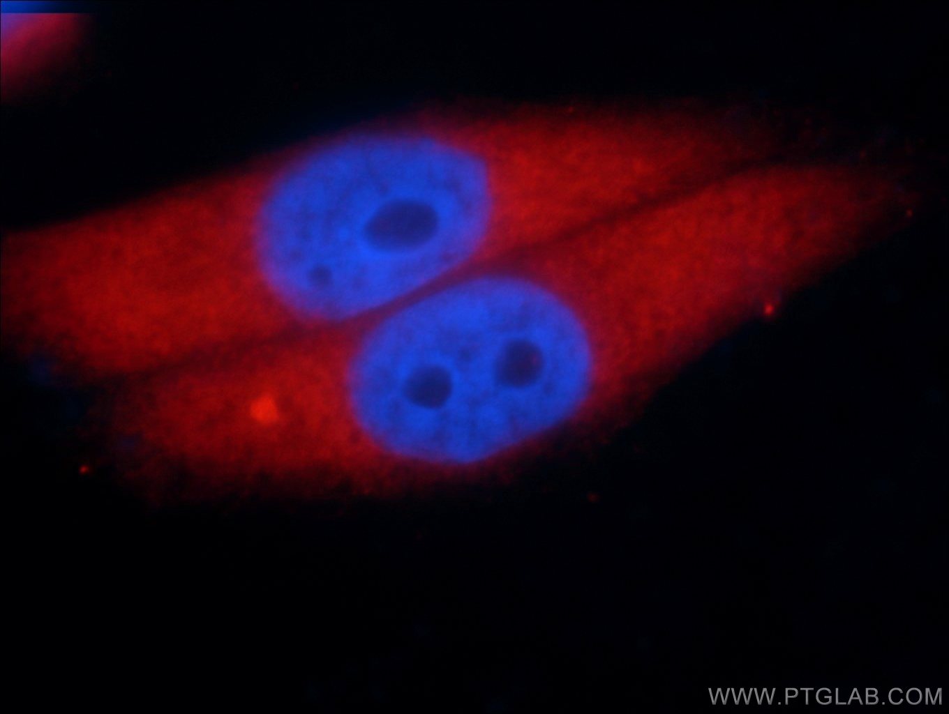 Immunofluorescence (IF) / fluorescent staining of HepG2 cells using Aldolase C Monoclonal antibody (66120-1-Ig)