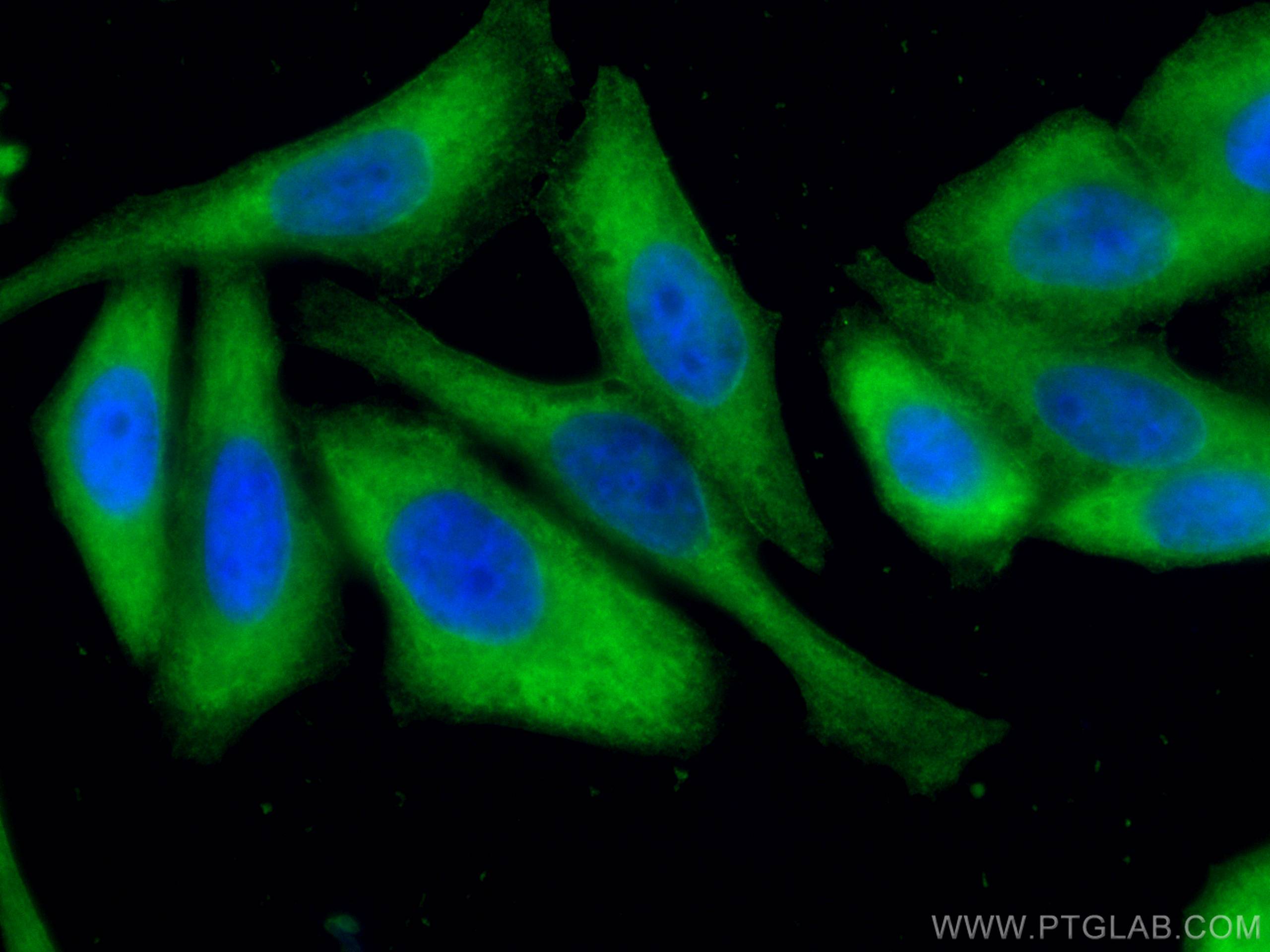 Immunofluorescence (IF) / fluorescent staining of HepG2 cells using Aldolase C Monoclonal antibody (66120-1-Ig)