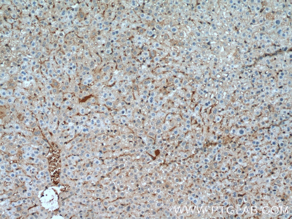 Immunohistochemistry (IHC) staining of mouse liver tissue using Aldolase C Monoclonal antibody (66120-1-Ig)