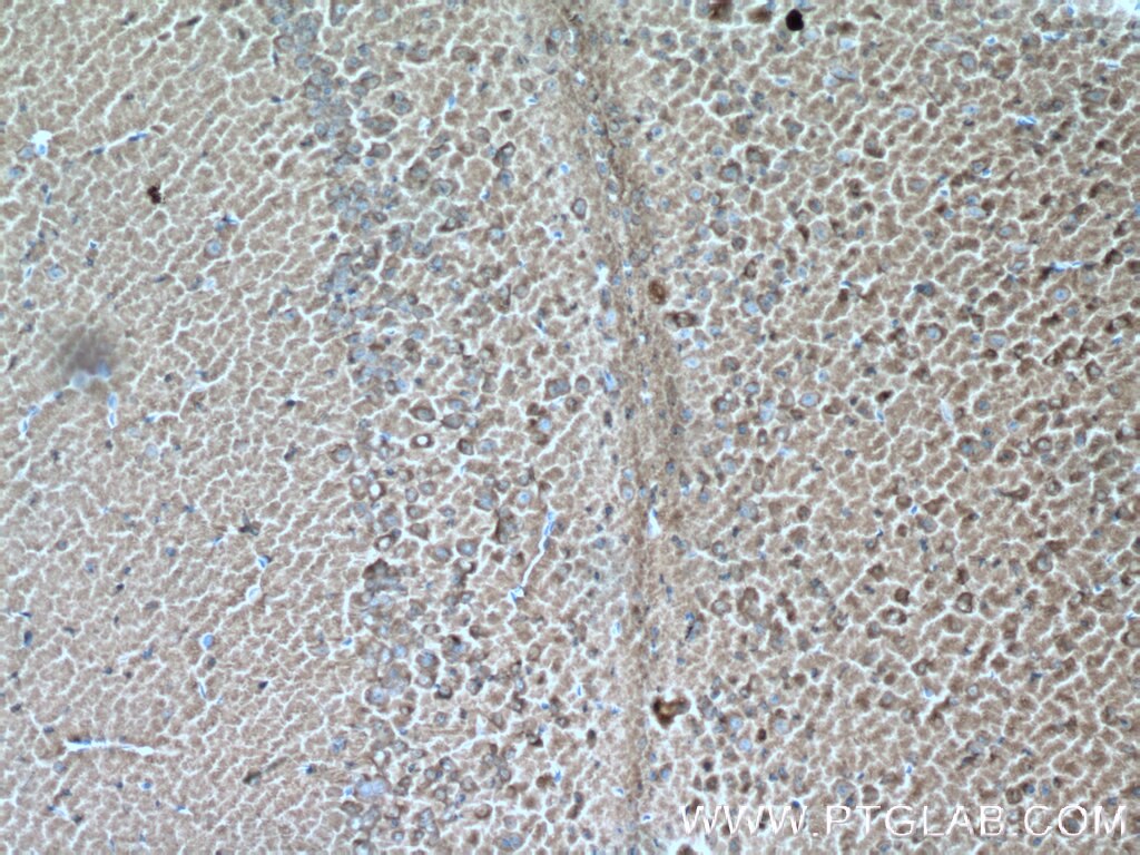 Immunohistochemistry (IHC) staining of mouse brain tissue using Aldolase C Monoclonal antibody (66120-1-Ig)